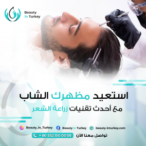 زراعة الشعر