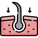 زراعة الشعر