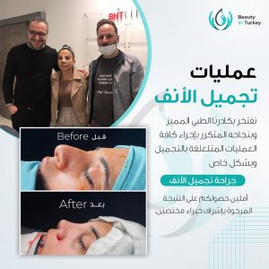 مراحل ما بعد عملية تجميل الأنف
